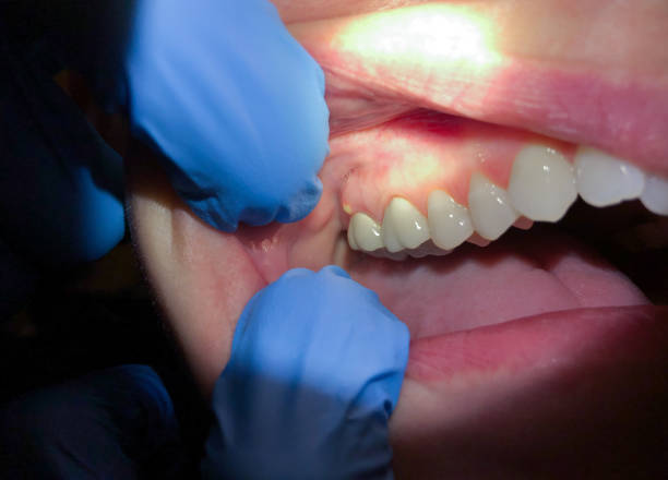 Best Tooth Pain Emergency Relief  in Washington, DC